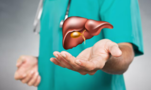 When Should You See a Liver Transplant Specialist in Kochi