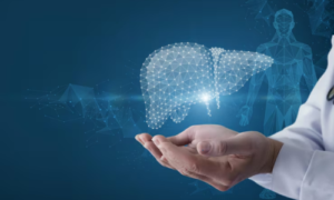 Liver Transplant Physician in Kochi, Eligibility, Procedure & Recovery Guide